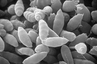 cypress-micro325 Scanning electron micrograph of Seiridium cardinale, a fungal pathogen responsible for a global pandemic of cypress canker disease. (Photo by Alberto Panconesi, Italian National Research Council)
