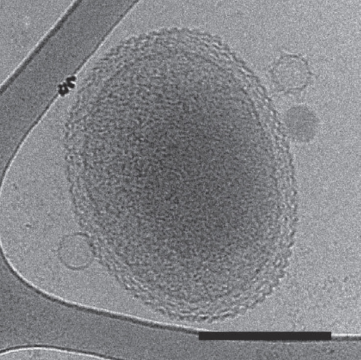 A cryo-electron tomography image of an ultra-small bacteria similar