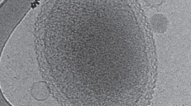 A cryo-electron tomography image of an ultra-small bacteria microbe wit phanges